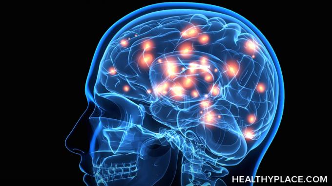 Kā Parkinsona slimības smadzenes atšķiras? Uzziniet, kā Parkinsona darbība ietekmē smadzenes un kas parādās smadzeņu skenēšanā, vietnē HealthyPlace. 
